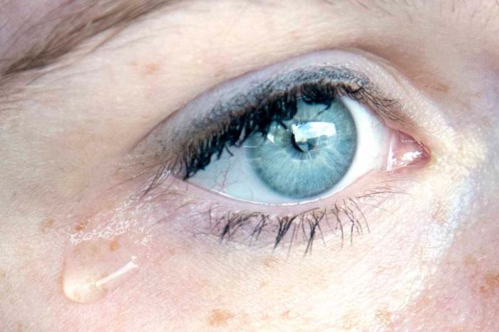 Evidence of Zika virus found in tears