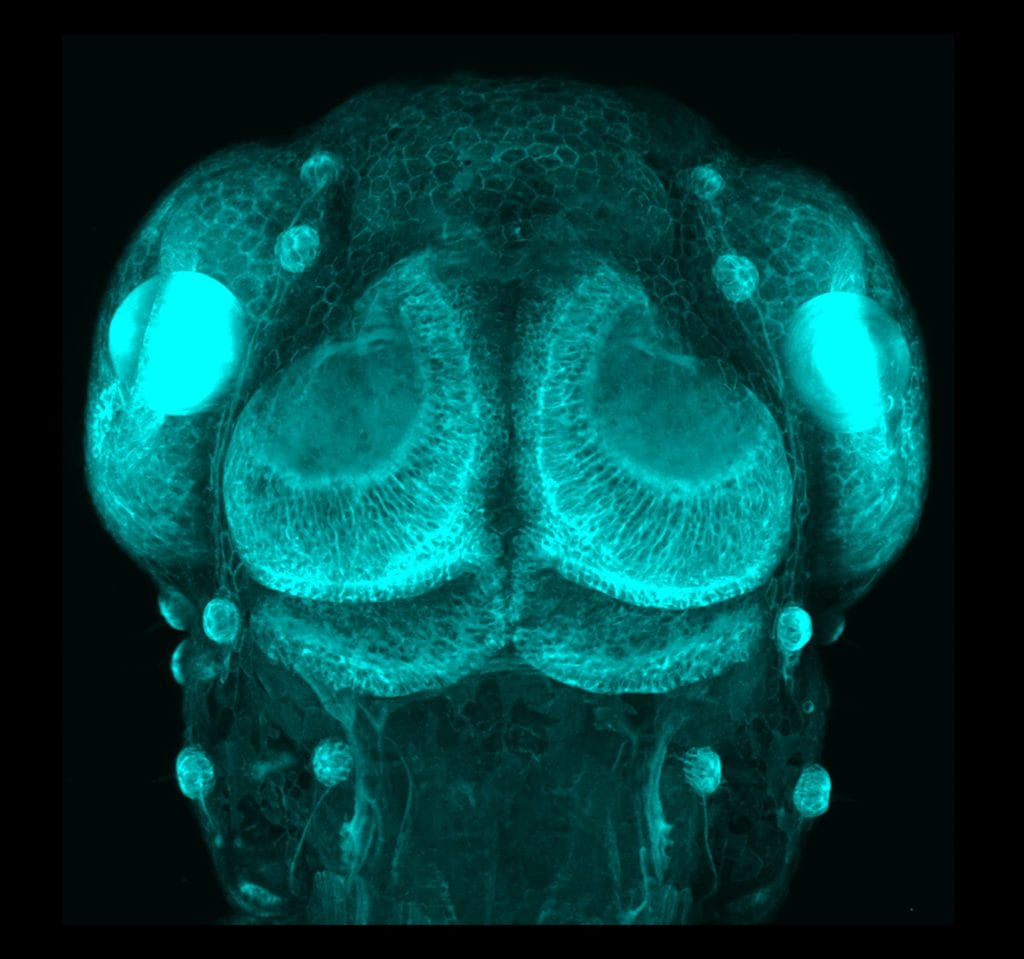 Larval zebrafish head in pax6-DF4:mCFP transgenic line. Image credit: Takeshi Yoshimatsu