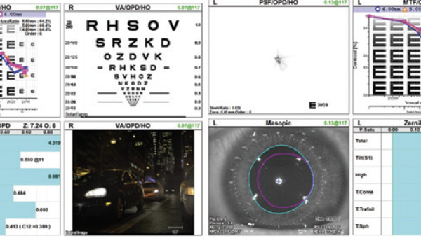 Treatment Strategies for Vision Loss Due to Thygeson Superficial Punctate Keratitis