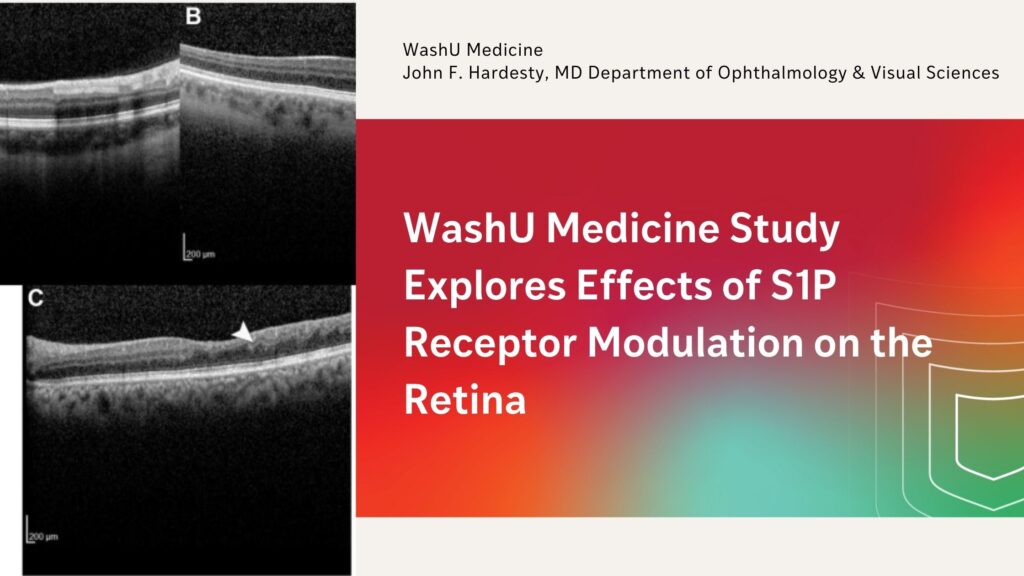 Study Explores Effects of S1P Receptor Modulation on the Retina