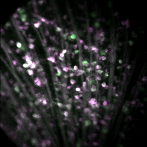 Real time 2-photon image from a living mouse eye distinguishing retinal ganglion cell neurons with low ATP (green) from neurons with high (magenta) in response to metabolic challenge.