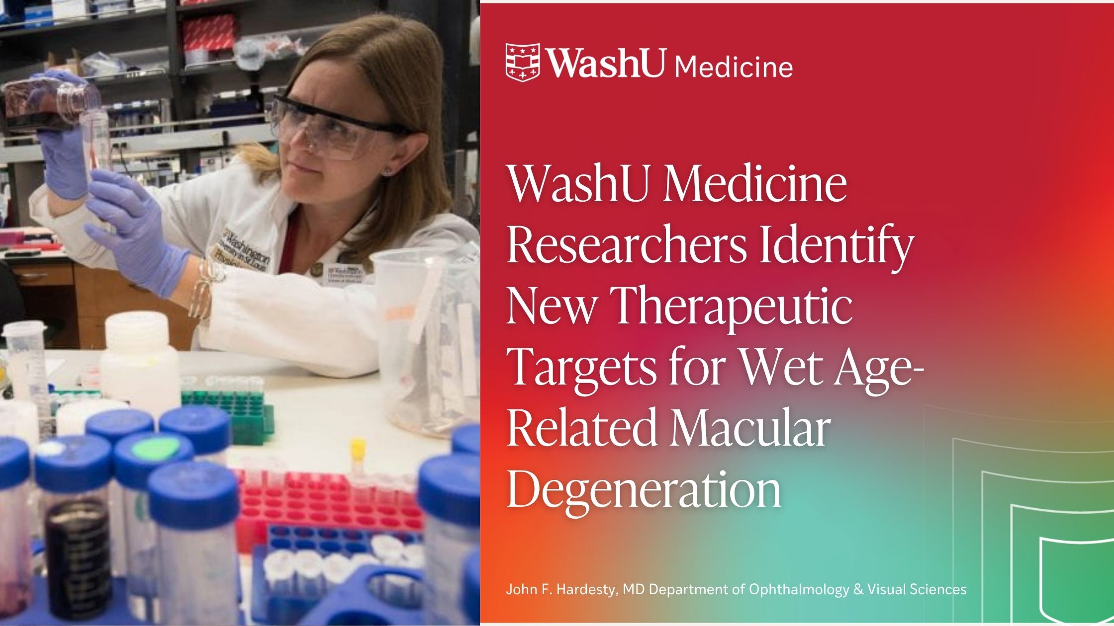 WashU Medicine Researchers Identify New Therapeutic Targets for Wet Age-Related Macular Degeneration