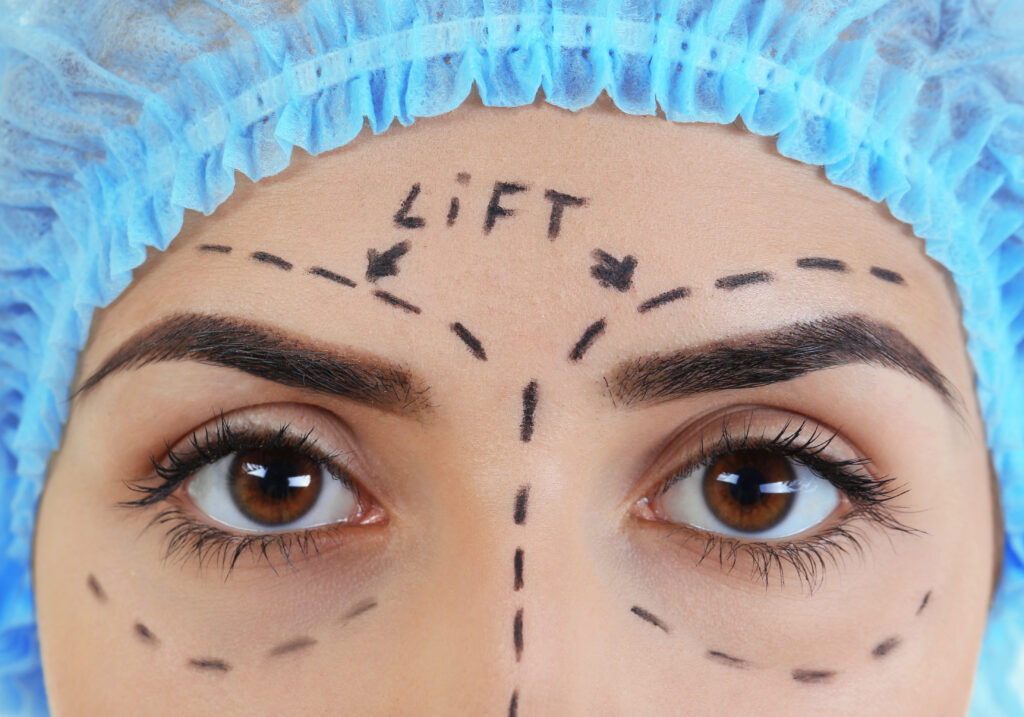 Endoscopic Brow Lift Ophthalmology & Visual Sciences